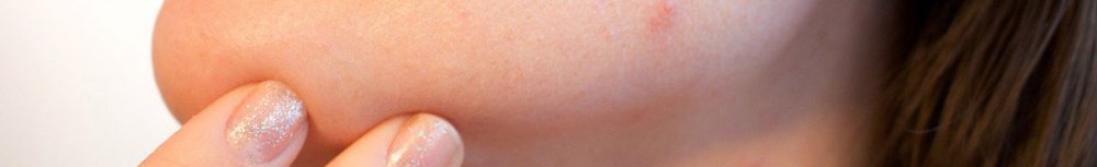 Comment lutter contre l&rsquo;acn&eacute; avec des huiles essentielles&thinsp;?