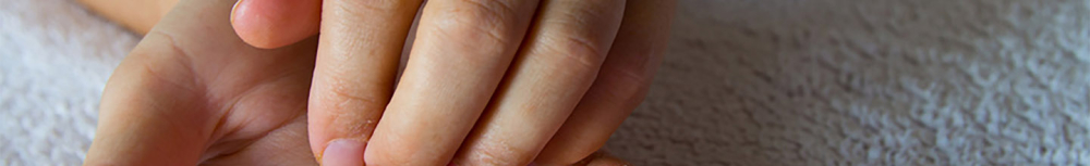 Comment reconna&icirc;tre une allergie cutan&eacute;e ?