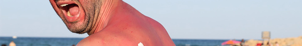 Qu'est-ce que l'allergie au soleil ?