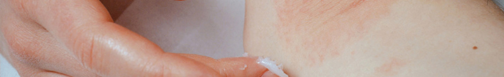 Qu'est ce que l'ecz&eacute;ma chez l'adulte ?