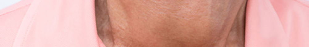 Quelles sont les causes de l'angine ?