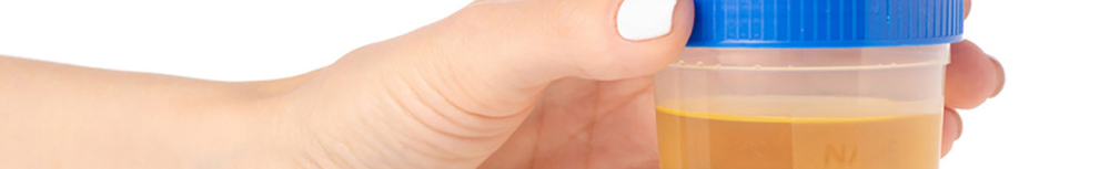 Sang dans les urines : l'infection urinaire peut-elle &ecirc;tre la cause ?