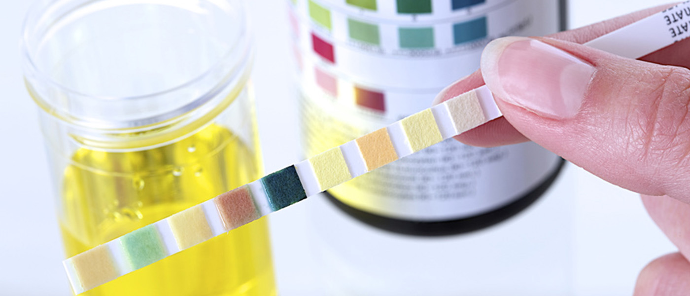 bandelettes urinaires pour detecter le regime cetogene
