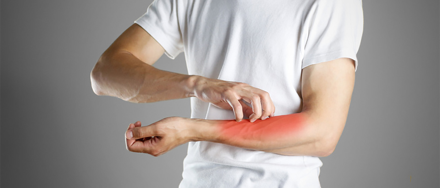 d&eacute;mangeaison allergie