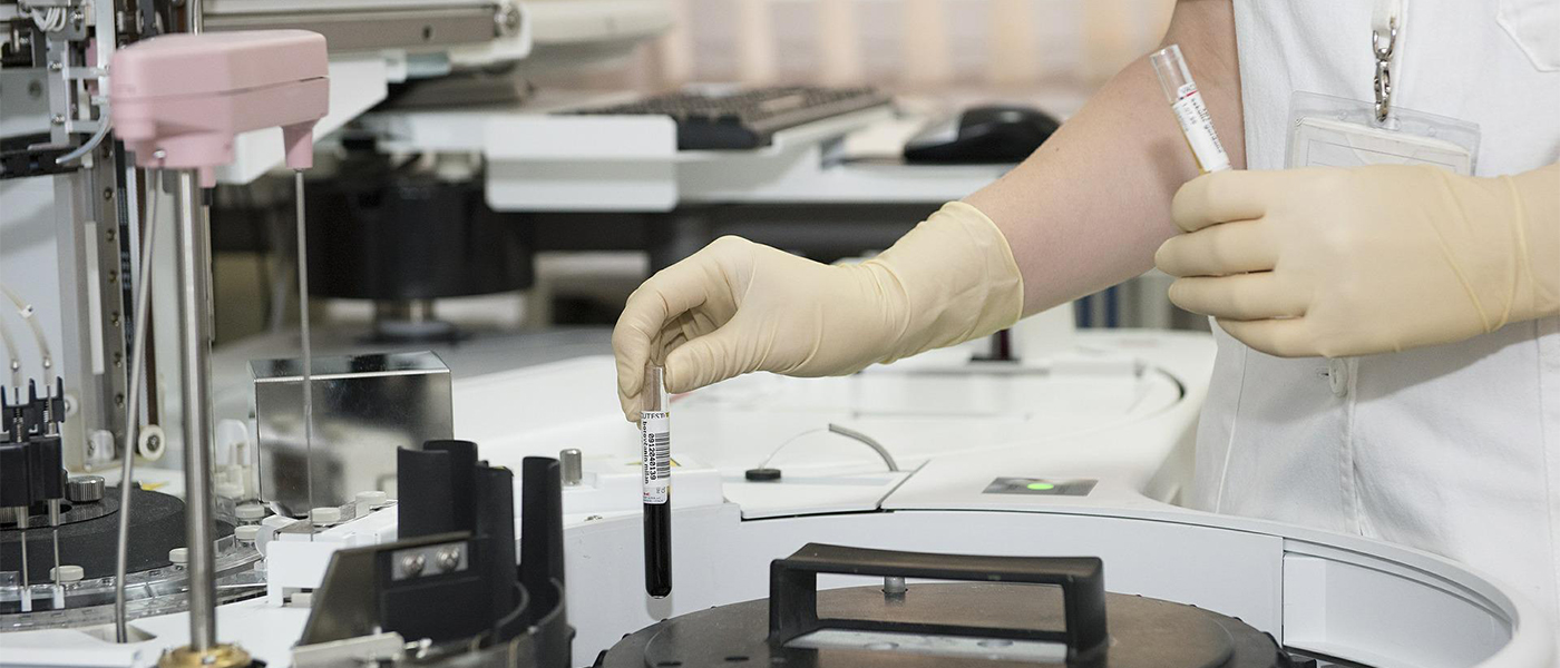 r&eacute;sultat prise de sang