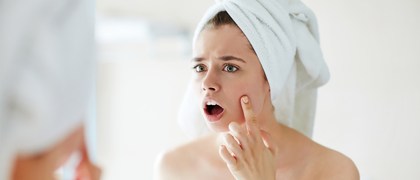 traitement de l'acn&eacute;