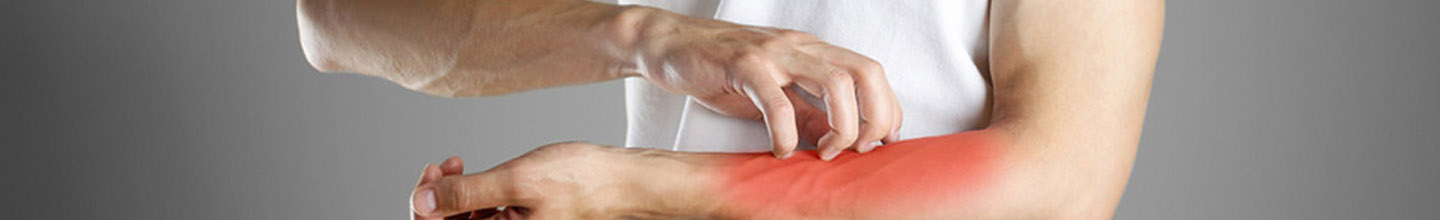 Quelles sont les diff&eacute;rentes causes de la dermatite atopique&nbsp;?