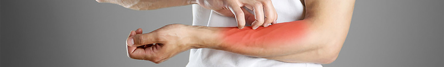 Comment peut-on attraper la gale ?