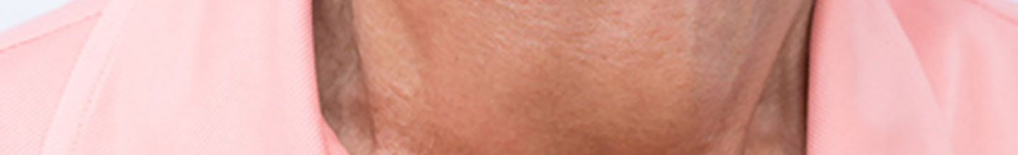 Quelles sont les causes de l'angine ?