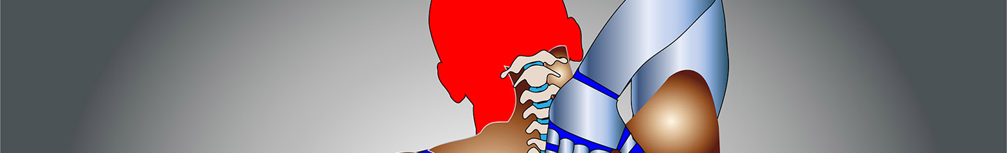 Qu'est-ce que la n&eacute;vralgie d'Arnold ?